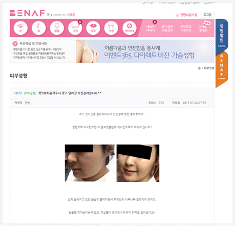 성형포털BNF